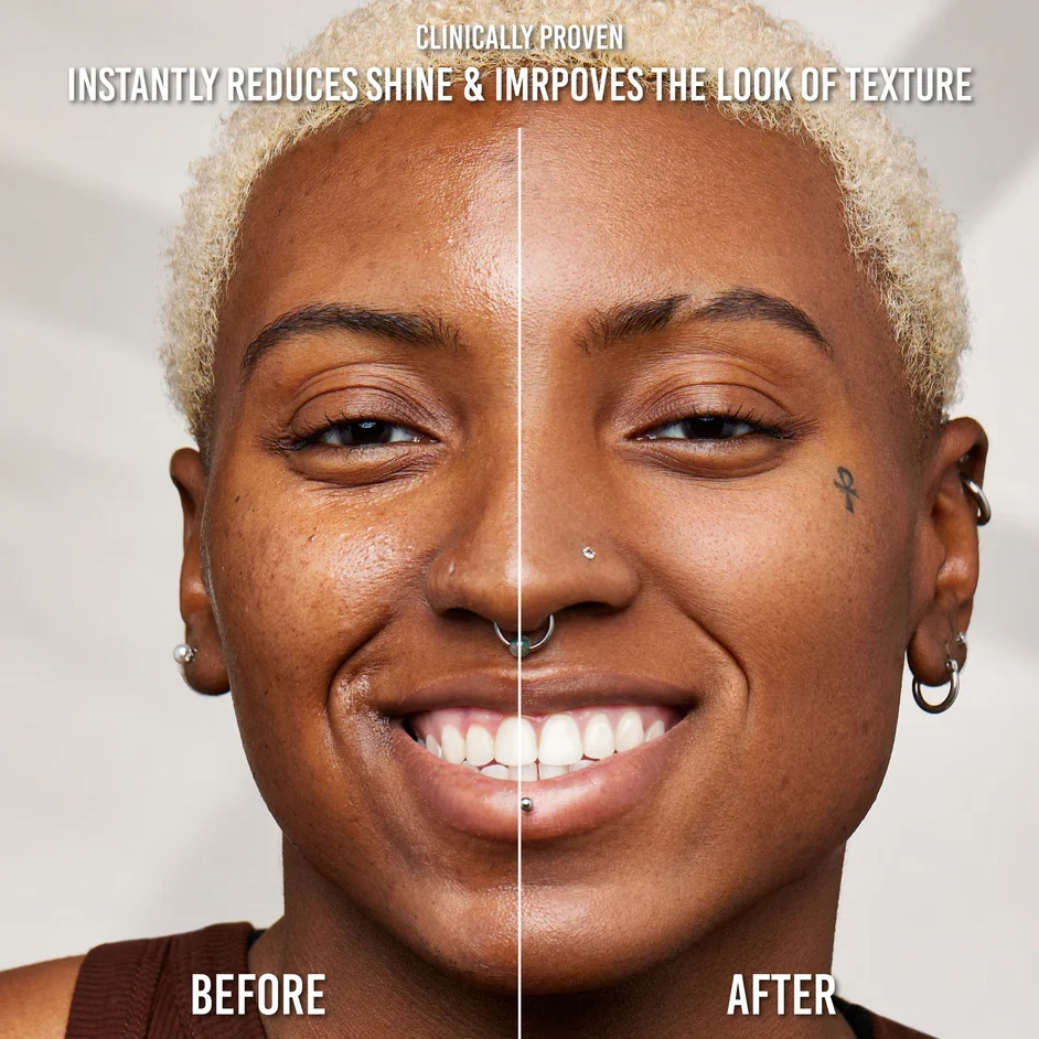 What Else You Need To Know